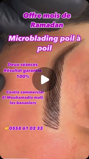 Résultat microblading publié par Dream Beauty